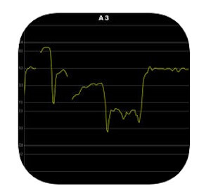 Vocal Pitch Monitor